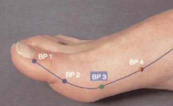 Puntos del Bazo/Páncreas
